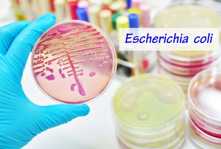 escherichia coli